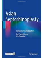 Asian Septorhinoplasty: Conundrums and Solutions