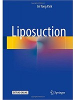 Liposuction