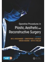 Operative Procedures in Plastic, Aesthetic and Reconstructive Surgery