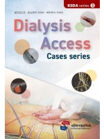 Dialysis Access - Case series /KSDA series 3