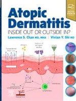 Atopic Dermatitis: Inside Out or Outside In