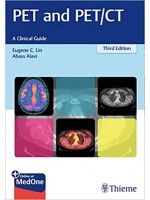 PET and PET/CT, 3e