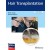 Hair Transplantation, 6e