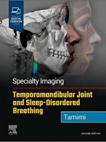 Specialty Imaging: Temporomandibular Joint and Sleep-Disordered Breathing, 2e