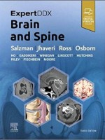 ExpertDDx: Brain and Spine 3e