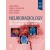 Neuroradiology: Key Differential Diagnoses and Clinical Questions, 2nd Edition