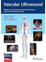 Vascular Ultrasound: B-Mode, Color Doppler and Duplex Ultrasound, Contrast-Enhanced Ultrasound