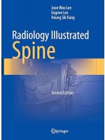 Radiology Illustrated: Spine  2/e