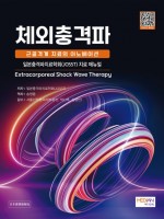 체외충격파: 근골격계 치료의 이노베이션