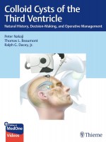 Colloid Cysts of the Third Ventricle: Natural History, Decision-Making, and Operative Management