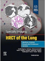 Specialty Imaging: HRCT of the Lung, 3rd Edition