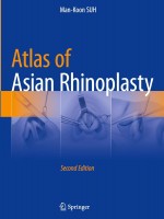Atlas of Asian Rhinoplasty, 2e