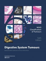 WHO Classification of Digestive Tumours, 6e