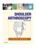 Shoulder Arthroscopy,2/e