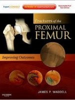 Fractures of the Proximal Femur: Improving Outcomes