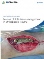 Manual of Soft-tissue Management in Orthopaedic Trauma