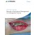 Manual of Soft-tissue Management in Orthopaedic Trauma