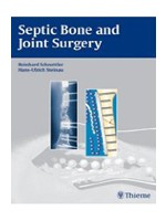 Septic Bone and Joint Surgery