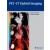 PET-CT Hybrid Imaging