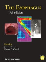 The Esophagus, 5/e