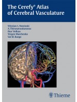 The Cerefy Atlas of Cerebral Vasculature/CD-ROM