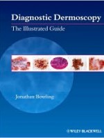 Diagnostic Dermoscopy: The Illustrated Guide