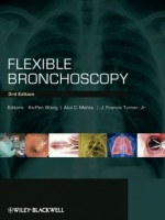 Flexible Bronchoscopy, 3/e
