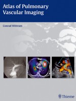Atlas of Pulmonary Vascular Imaging : A Multimodality Approach