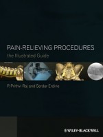 Pain-Relieving Procedures: The Illustrated Guide