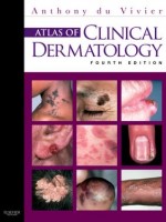 Atlas of Clinical Dermatology, 4/e
