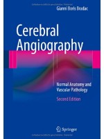 Cerebral Angiography: Normal Anatomy and Vascular Pathology