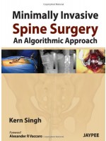 Minimally Invasive Spine Surgery: An Algorithmic Approach