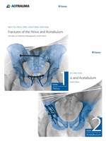 Fractures of the Pelvis and Acetabulum