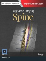 Diagnostic Imaging: Spine, 3e