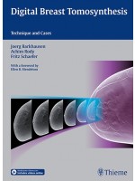 Digital Breast Tomosynthesis