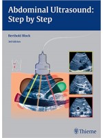 Abdominal Ultrasound Step by Step , 3/e