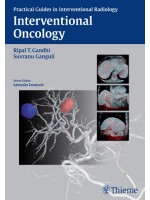 Interventional Oncology