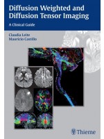 Diffusion Weighted and Diffusion Tensor Imaging