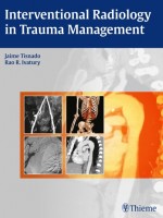 Interventional Radiology in Trauma Management