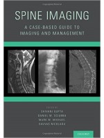 Spine Imaging: A Case-Based Guide to Imaging and Management