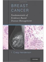 Breast Cancer: Fundamentals of Evidence-Based Disease Management