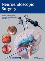 Neuroendoscopic Surgery