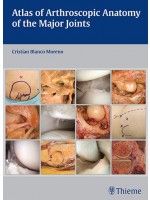 Atlas of Arthroscopic Anatomy of Major Joints