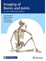 Imaging of Bones and Joints A Concise, Multimodality Approach