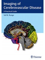 Imaging of Cerebrovascular Disease A Practical Guide