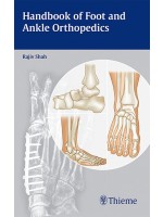 Handbook of Foot and Ankle Orthopedics