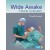Wide Awake Hand Surgery