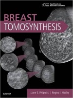 Breast Tomosynthesis, 1e