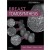 Breast Tomosynthesis, 1e