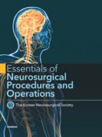 Essentials of Neurosurgical Procedures and Operations